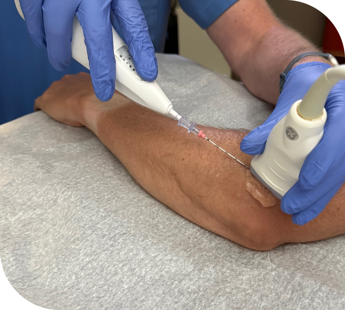 Tendonitis Treatment Nashville TN