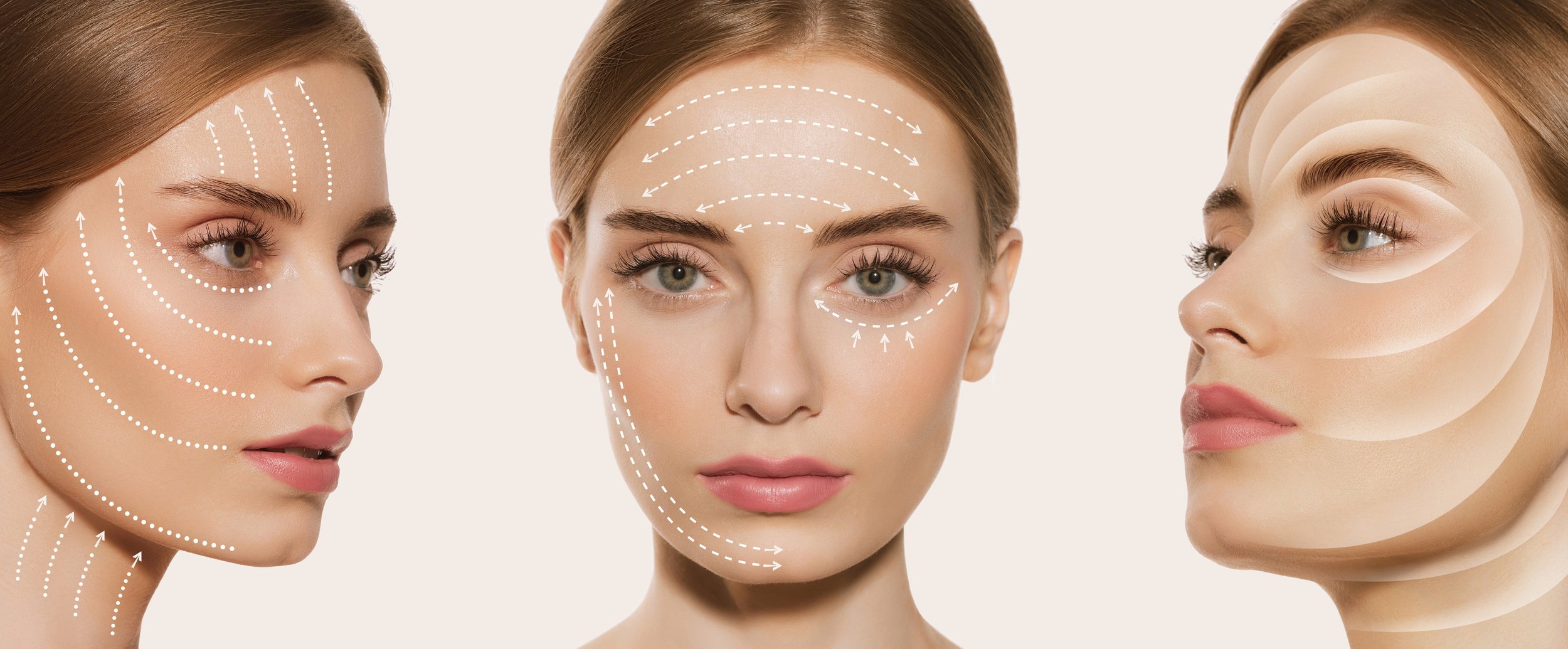 Three women with diagrams showing facial contouring or cosmetic treatment directions.