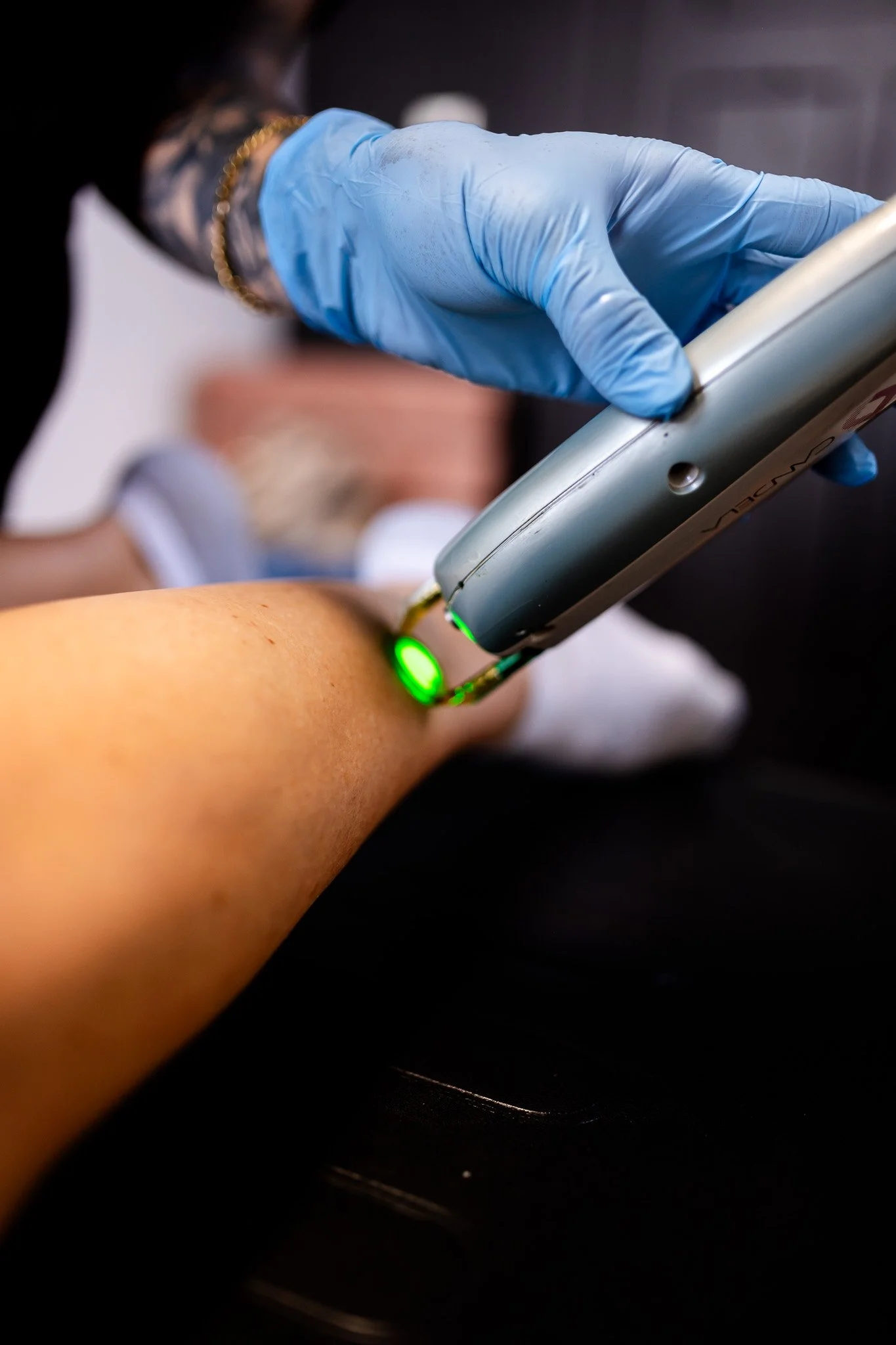 A healthcare professional wearing blue gloves uses a medical device on a patient's arm, with a green light indicating the device is in use.