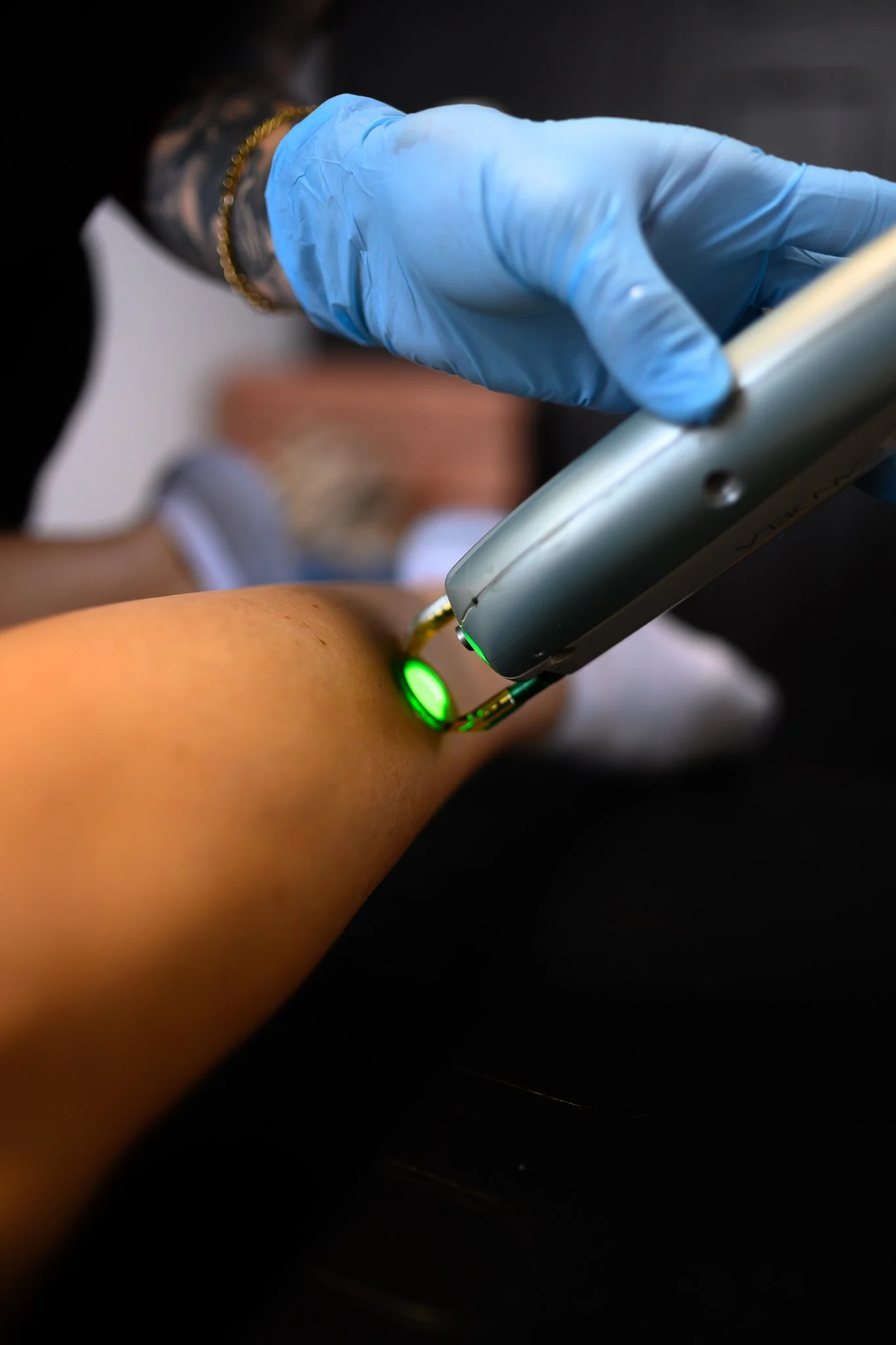 A healthcare professional wearing blue gloves using a medical device on a patient's arm, possibly for a diagnostic or treatment procedure.