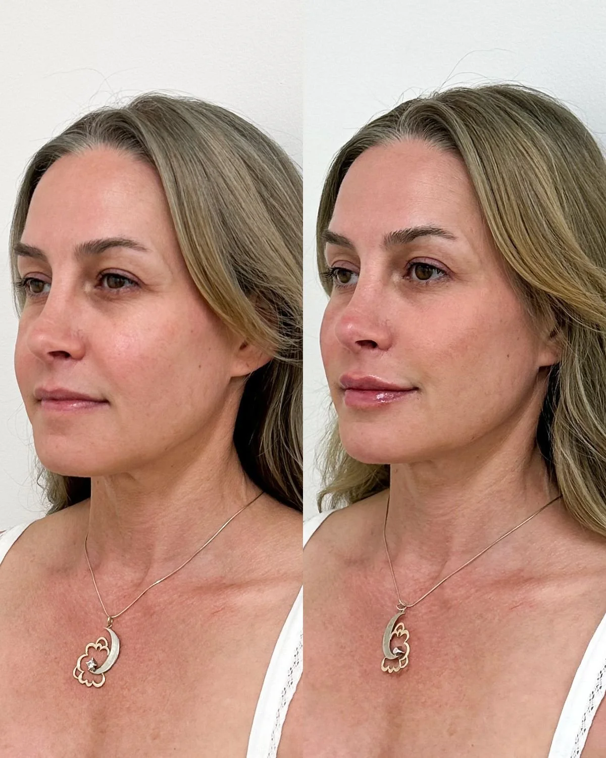 Copy of The Face of Aesthetics.jpg.JPG