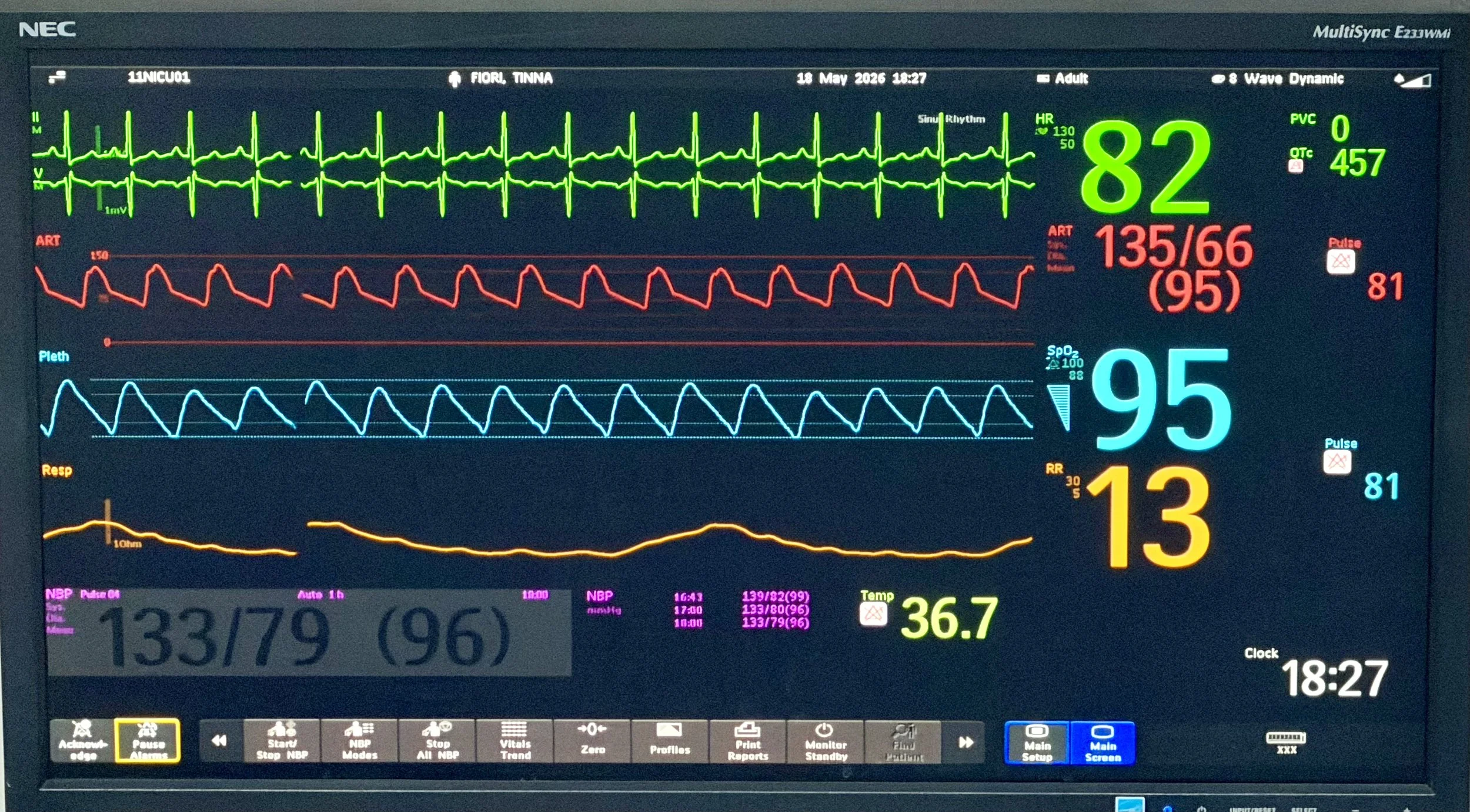 Day 1 of Recovery - 5/19/26