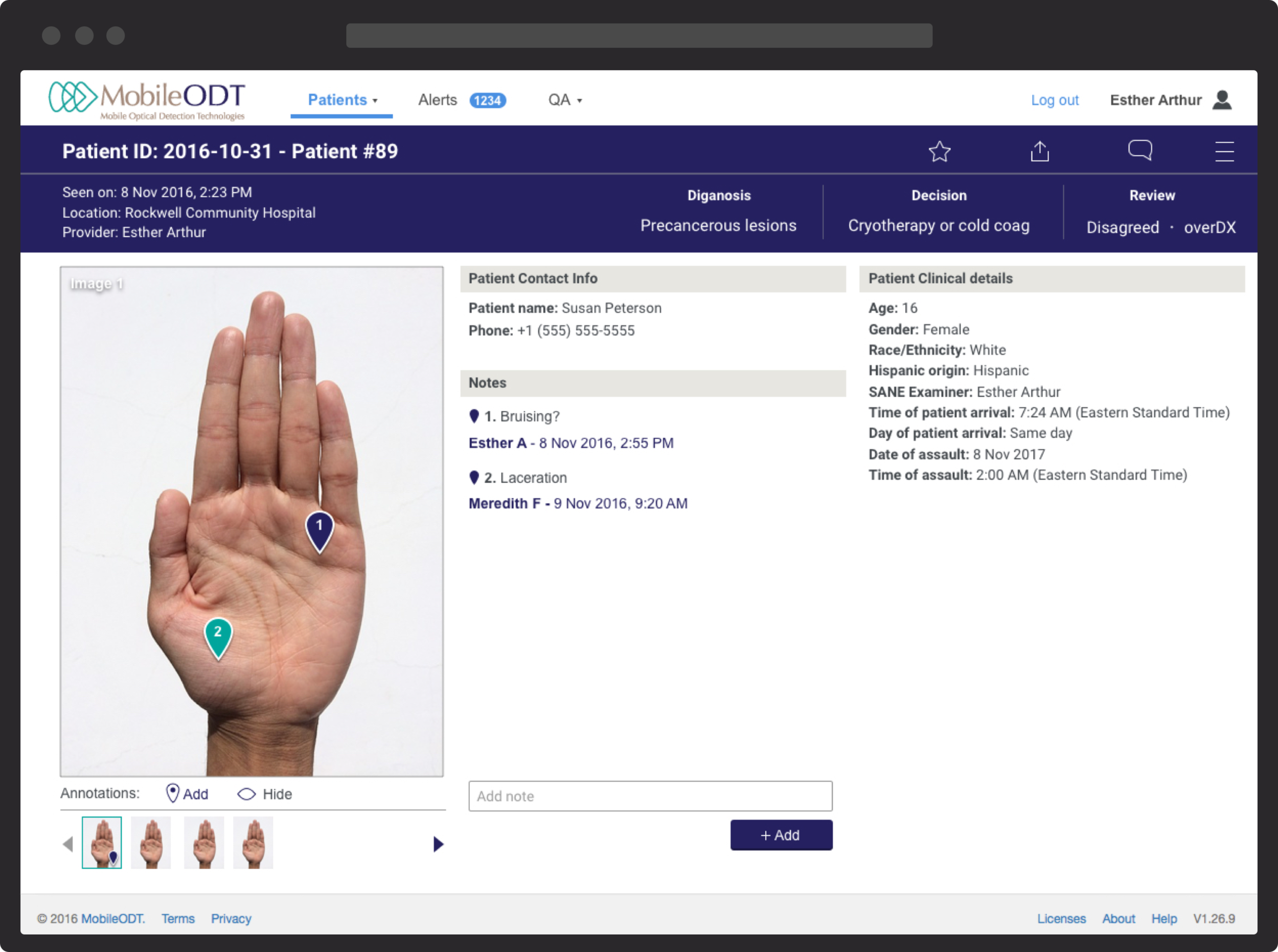 Patient case with annotations - “Profile B”/ own case view