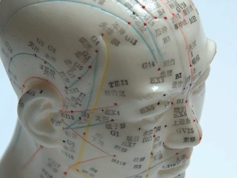 Acupuncture head model showing meridian pathways used in treatment