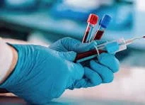 Specimen Processing & Packaging