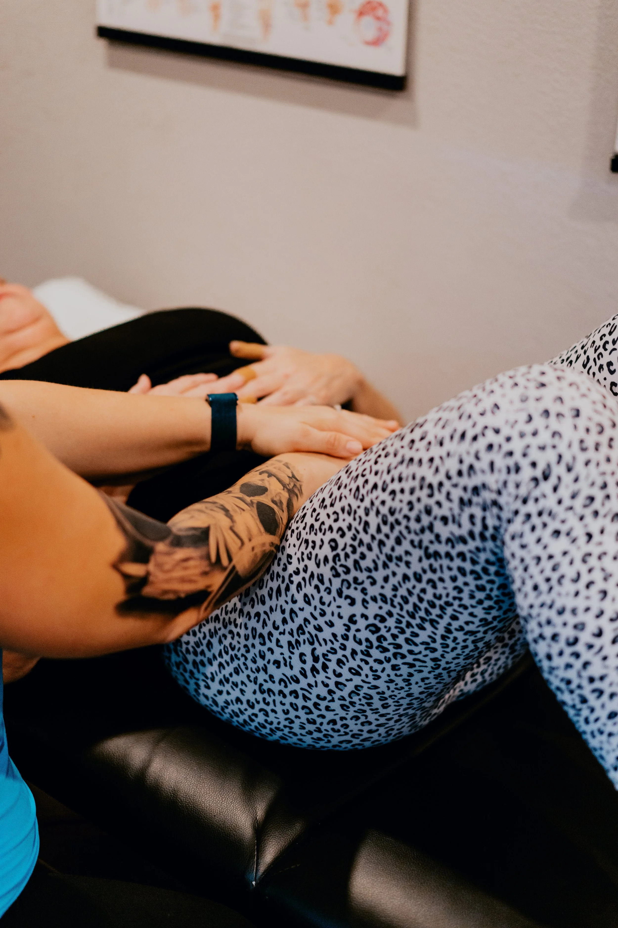 Exercising after a myomectomy