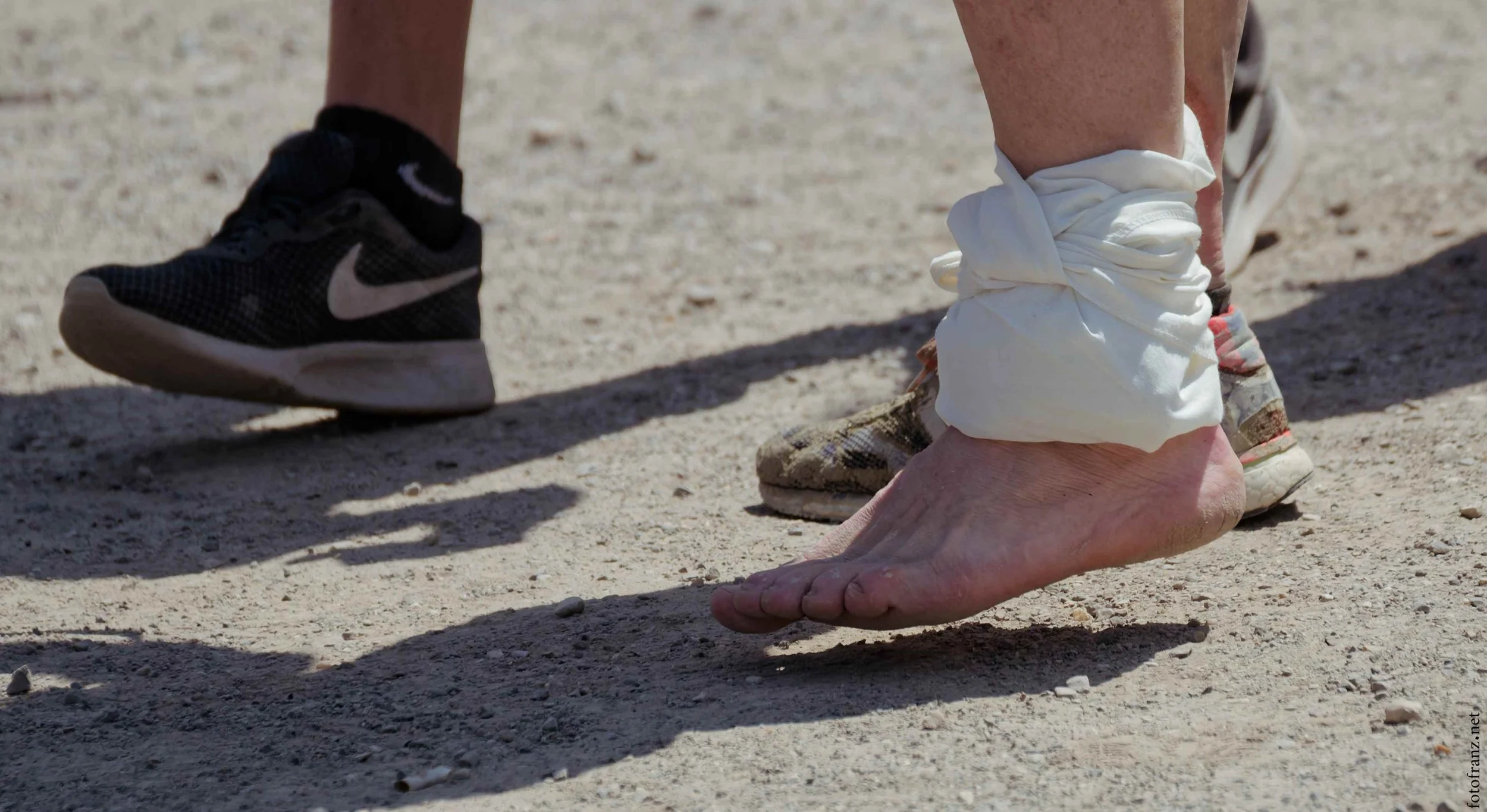 Nahaufnahme von zwei Personen, eine barfuß, die andere mit Sportschuhen, die auf einem sandigen Boden stehen. Die Person, die barfuß ist, ist am Knöchel verletzt