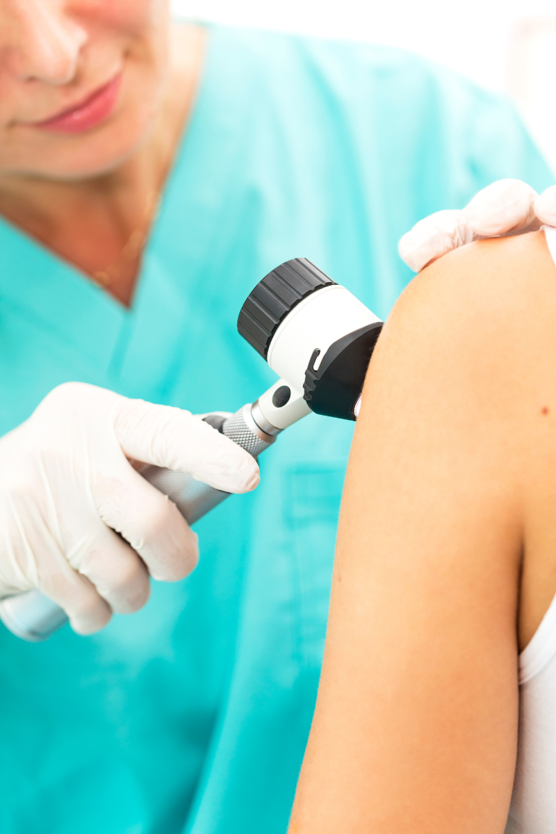 The ABCDEs of Melanoma: How to Spot Skin Cancer Early