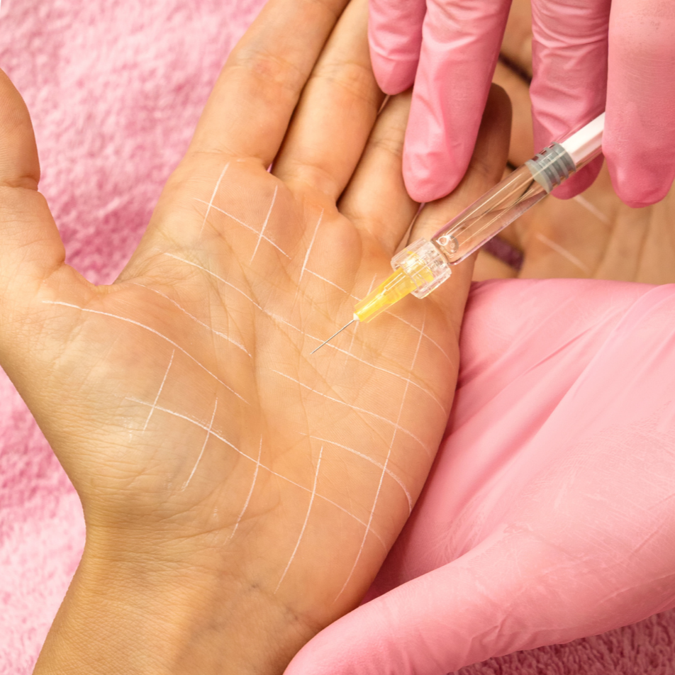 A person receiving an injection or blood draw in their palm, marked with white lines, while wearing pink gloves.