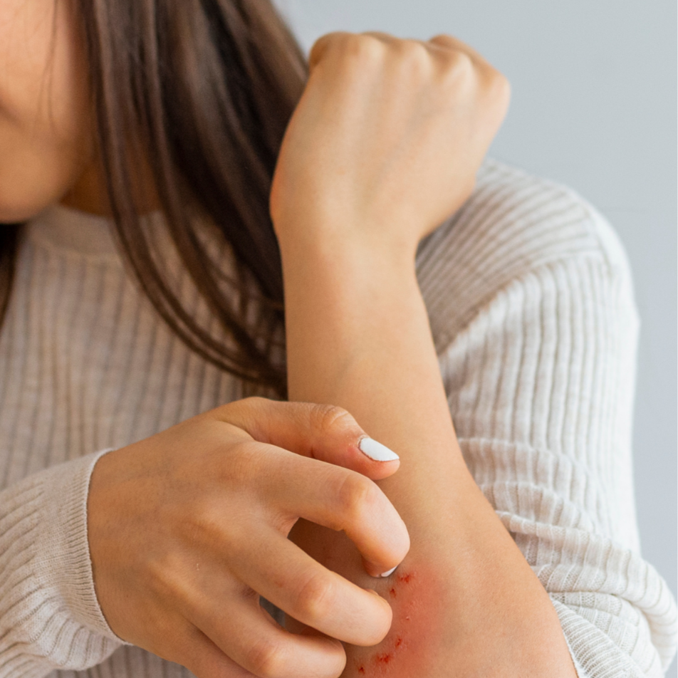 A woman showing a scratch or rash on her forearm.