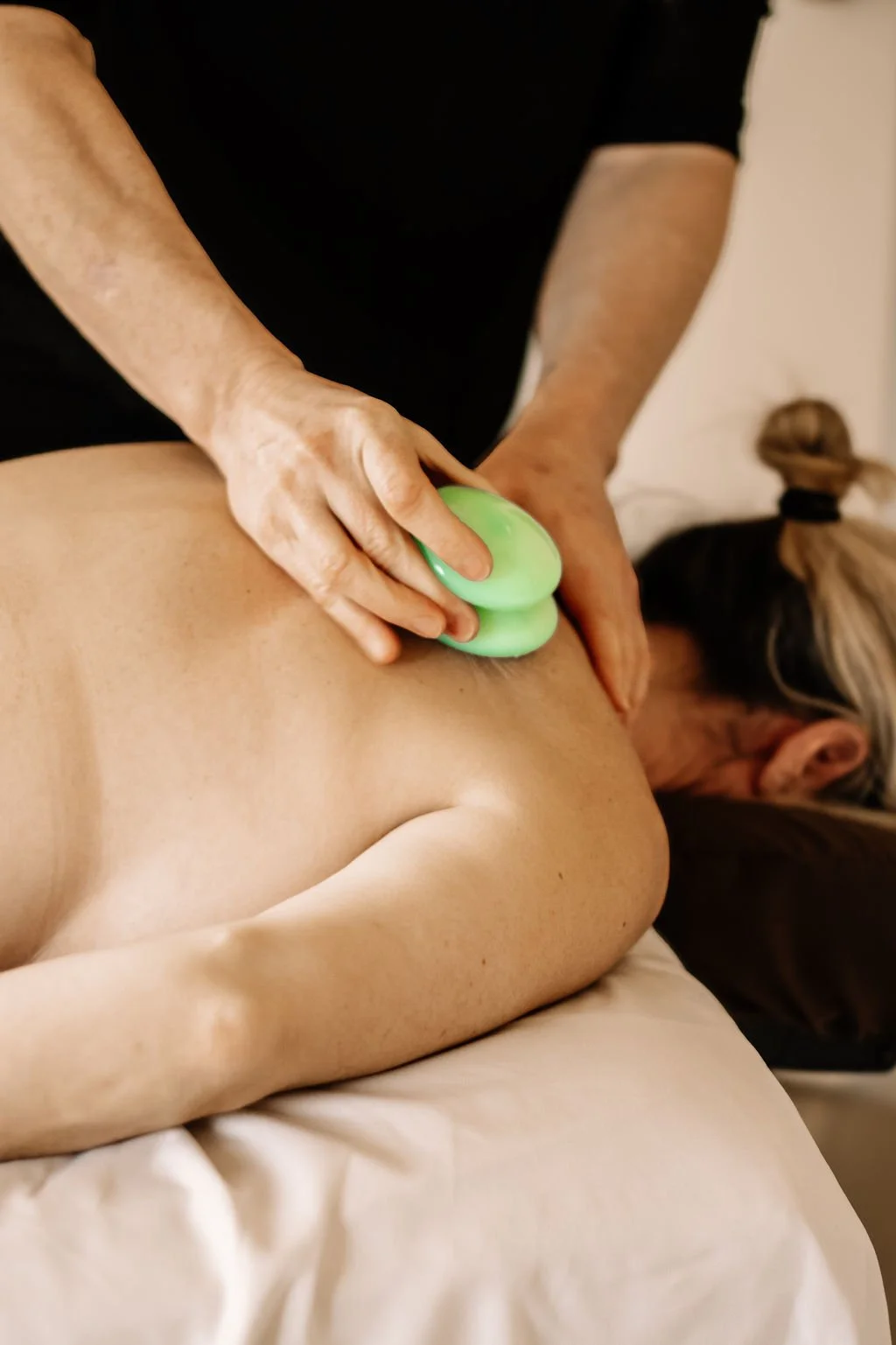 Woman receiving a cupping massage treatment.