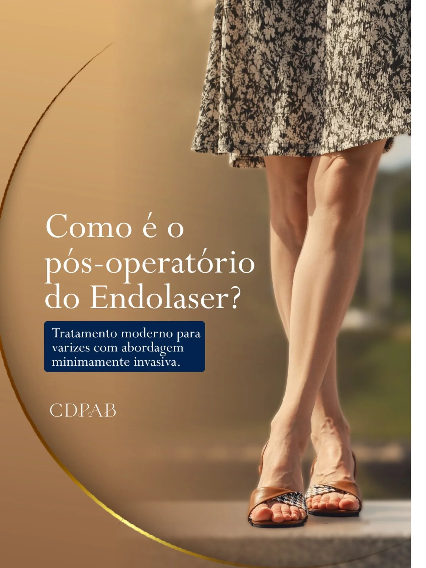 Uma das principais d&uacute;vidas de quem precisa tratar varizes &eacute; sobre o p&oacute;s-operat&oacute;rio.

No Endolaser, o procedimento &eacute; minimamente invasivo e realizado com anestesia local ou bloqueio, dependendo do caso.

De forma ger