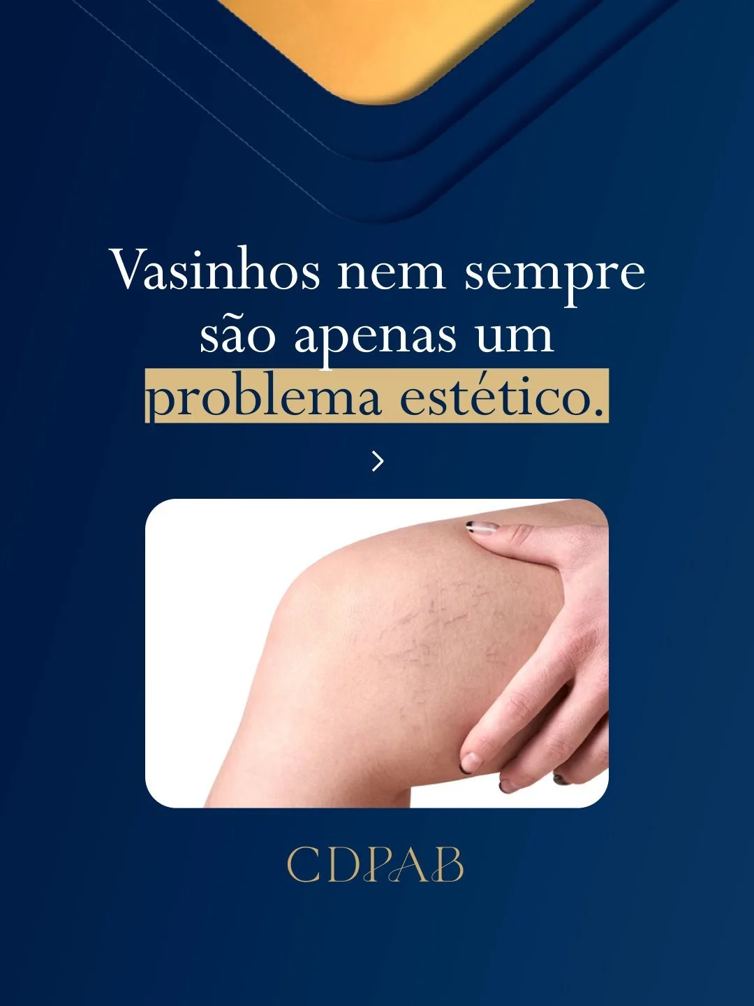 Nem sempre o que aparece na pele &eacute; apenas uma quest&atilde;o est&eacute;tica. Em alguns casos, altera&ccedil;&otilde;es mais profundas na circula&ccedil;&atilde;o podem estar envolvidas, e isso faz com que a avalia&ccedil;&atilde;o vascular se