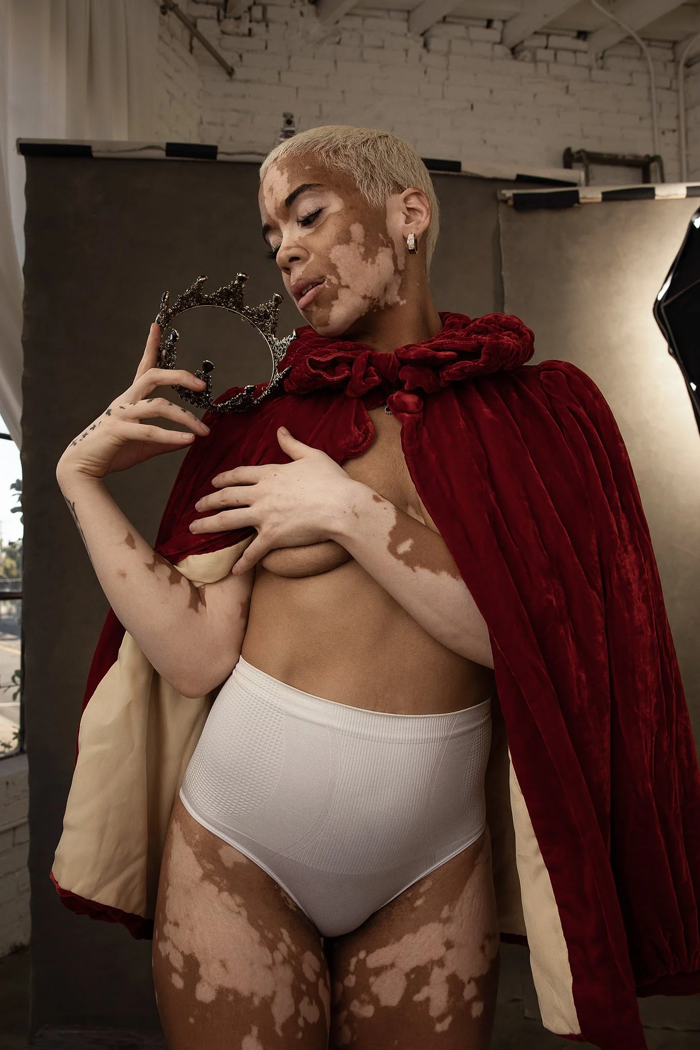 Baylee Vitiligo Portrait Nashville_1.JPG