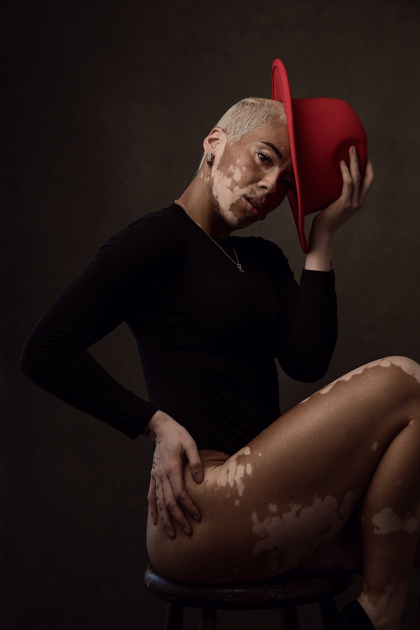Baylee Vitiligo Model Portrait Nashville_1.JPG