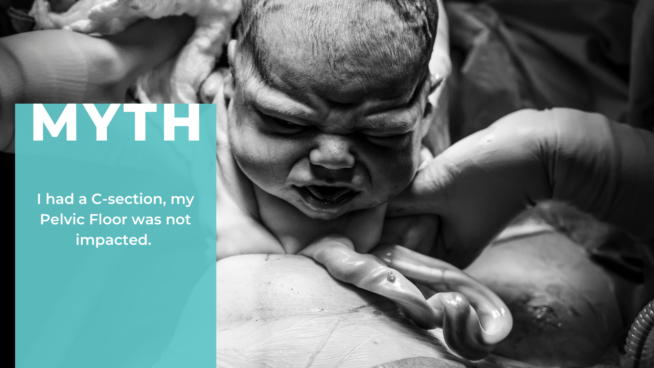 Recovery after a C-section, MYTH debunked.