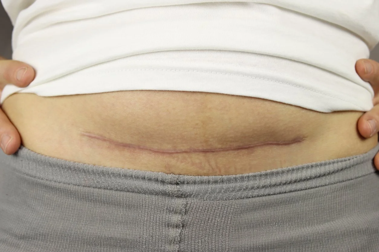 Don’t Hide Your Scars