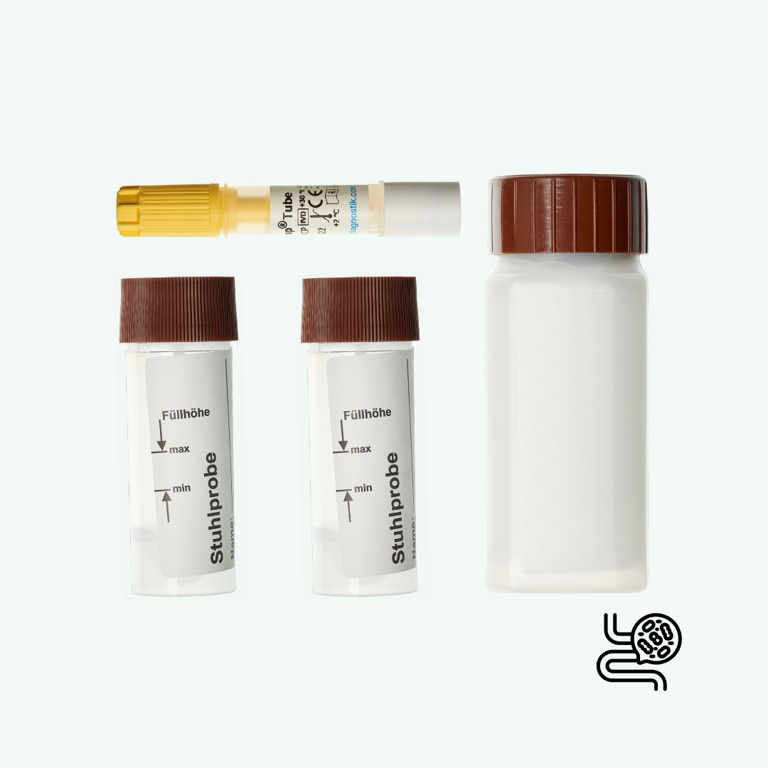 Urinteststreifen, Staubsammler, Behälter, und Y-strich Droxstick für Urinproben