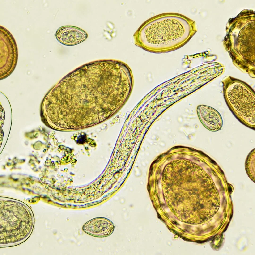 Mikroskopaufnahme von Parasiten, wahrscheinlich Wurm- oder Wurmlarven, umgeben von kleinen Partikeln und Zellen.