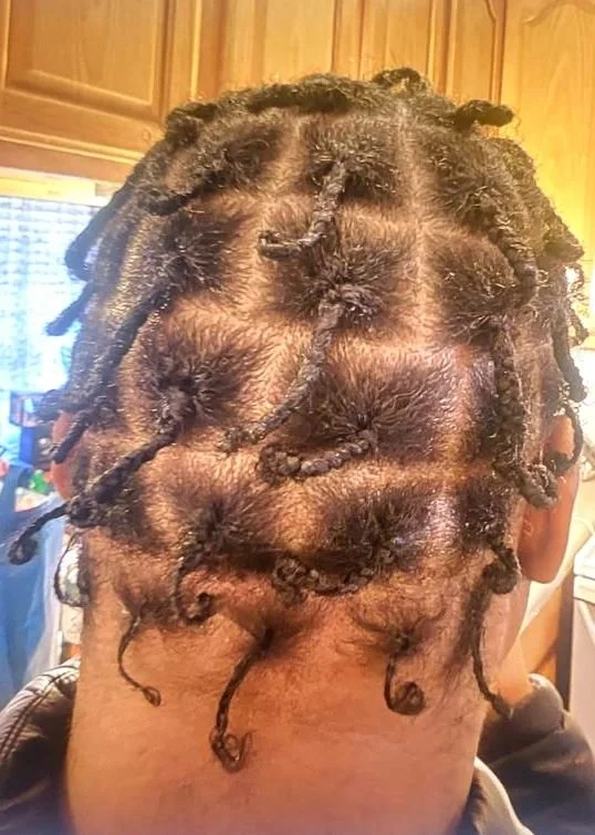 After photo showing visible hair regrowth with several inches of new length at the crown and hairline after hair consultation and following the 2125 Hair Plan.