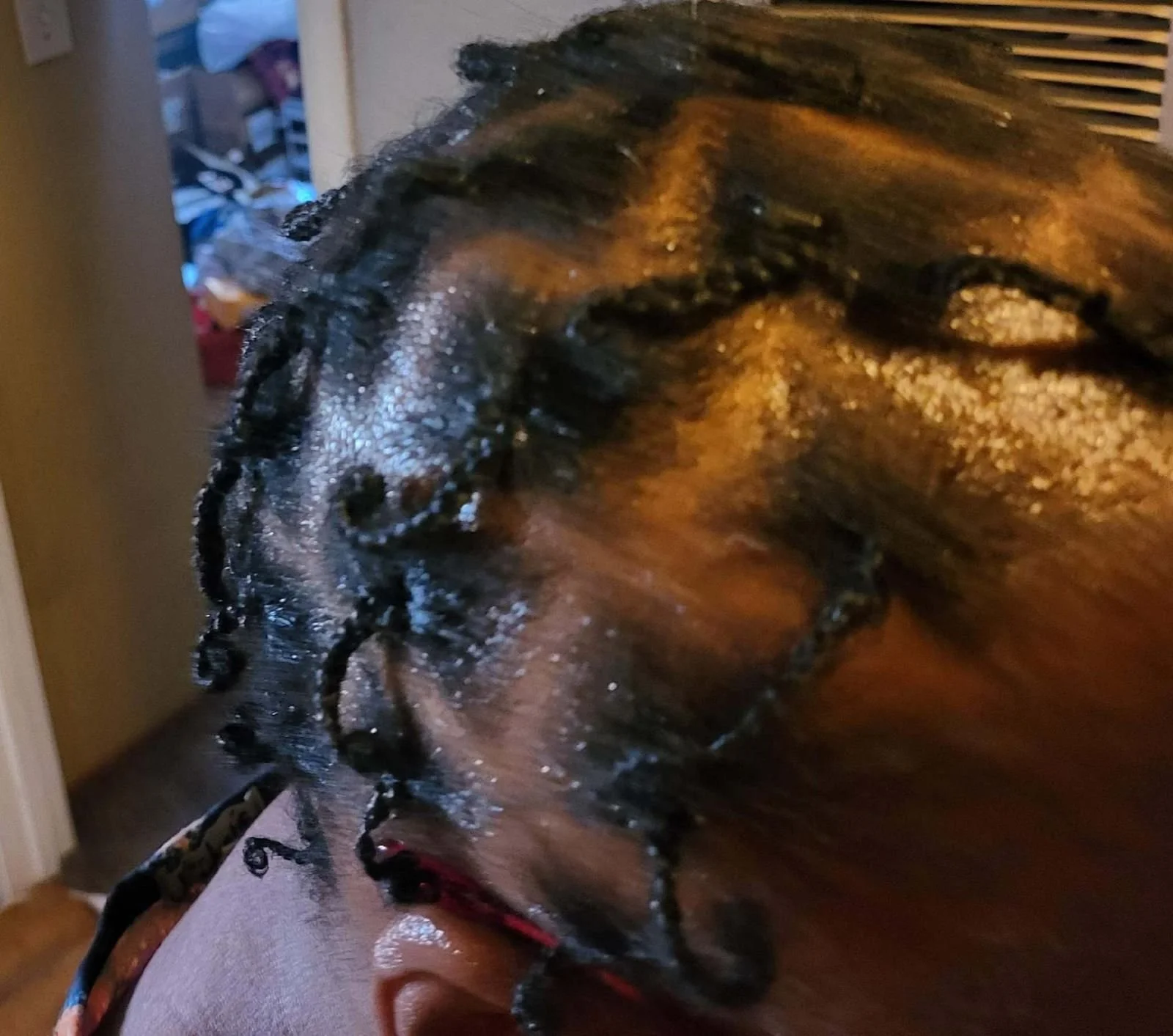 Dramatic hair regrowth results with several inches of new length and fuller coverage at the crown and hairline after following the 2125 Hair Plan with a trichology specialist.