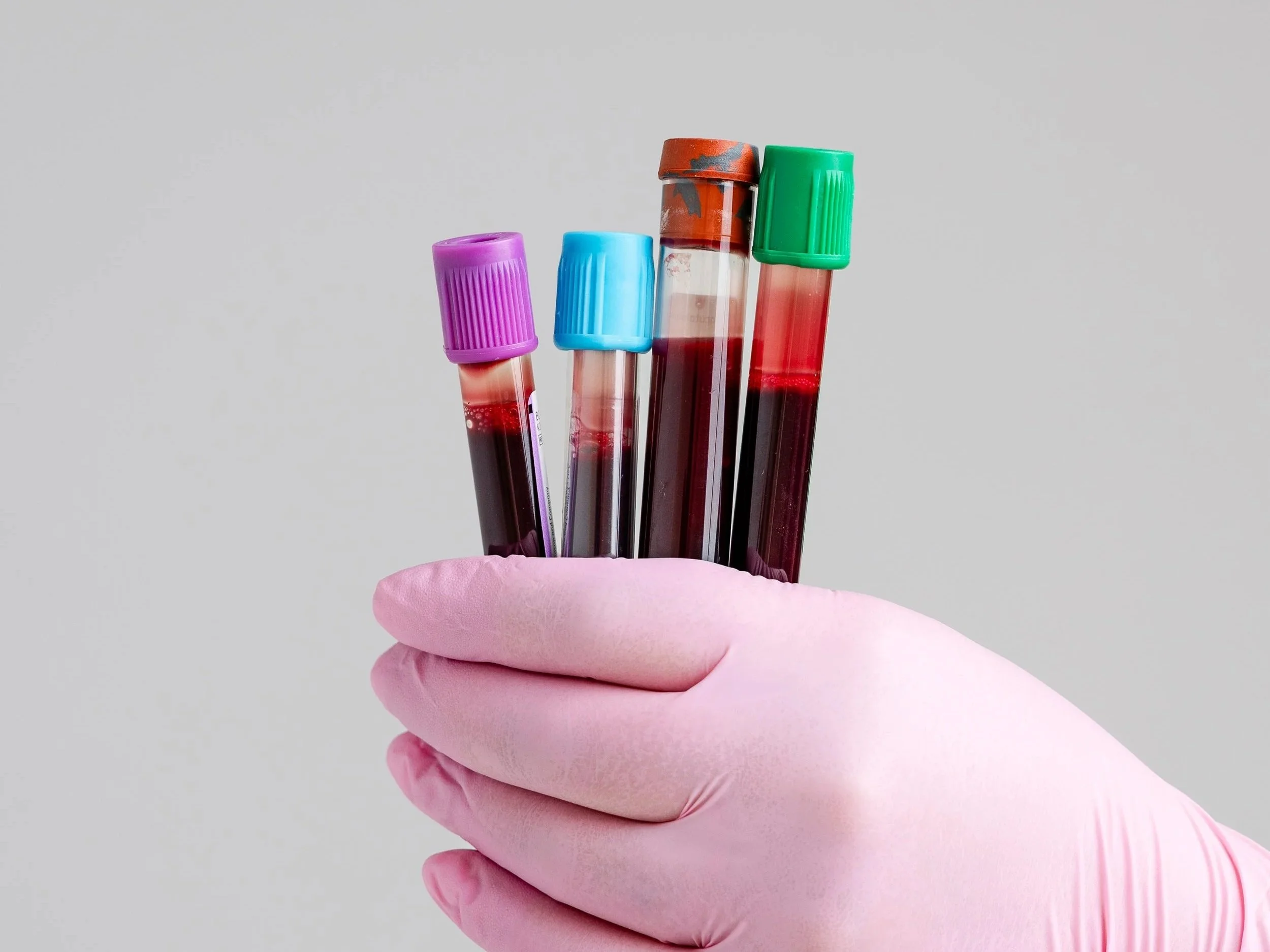 A hand wearing a pink glove holding four blood collection tubes with colored caps against a plain background.