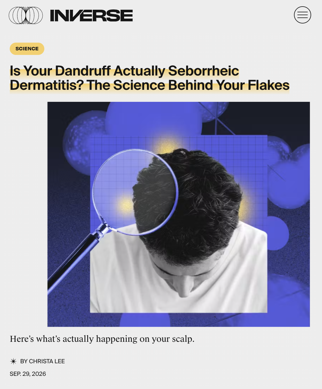 Is Your Dandruff Actually Seborrheic Dermatitis? The Science Behind Your Flakes