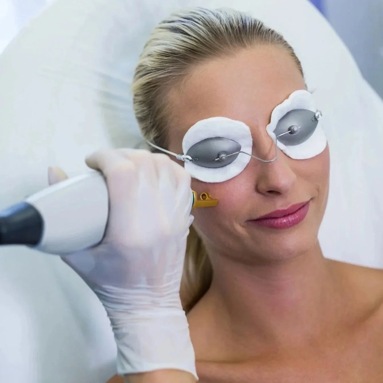 Fraxel Laser Skin Resurfacing in Melbourne, FL
