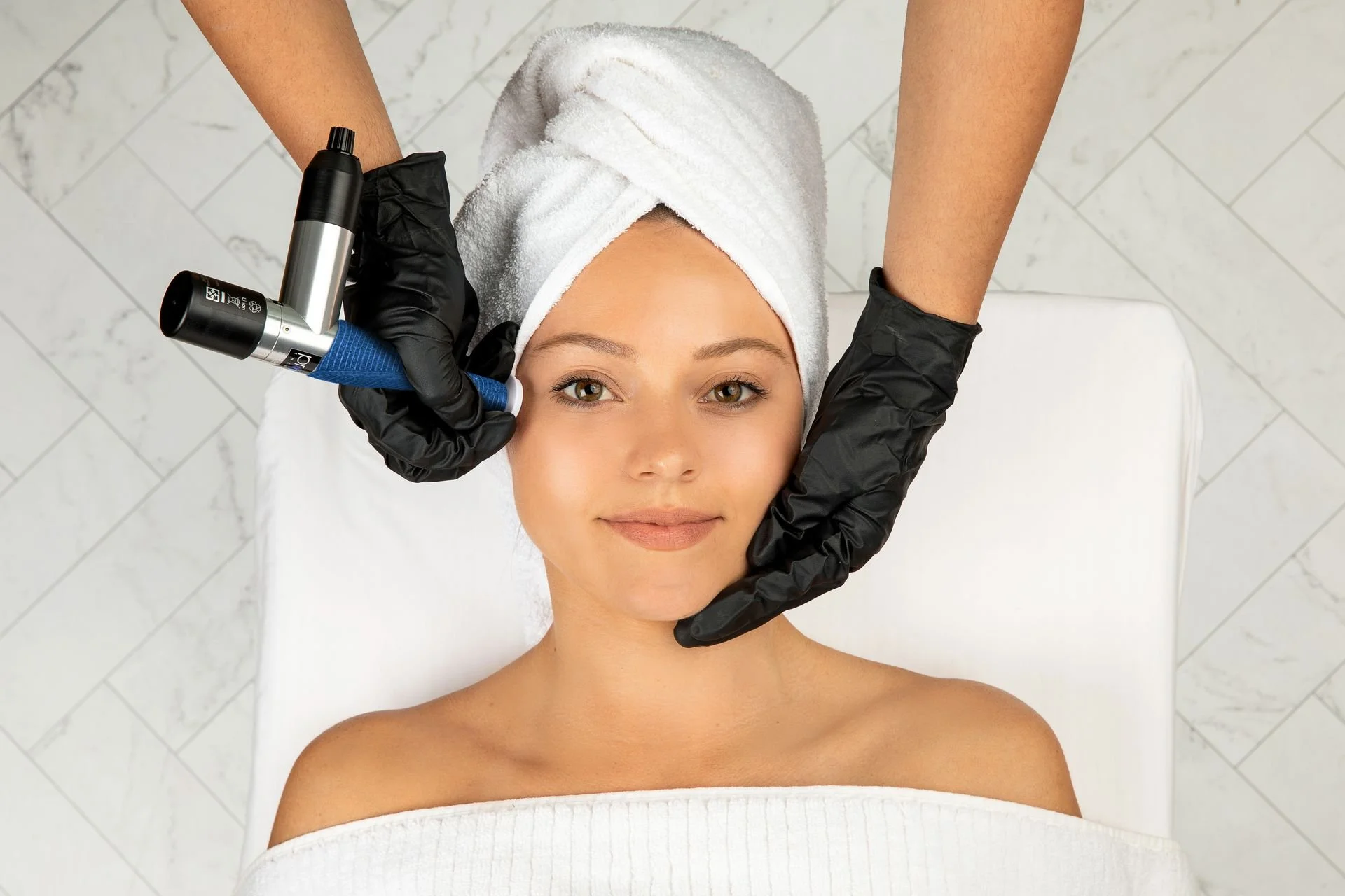Microneedling