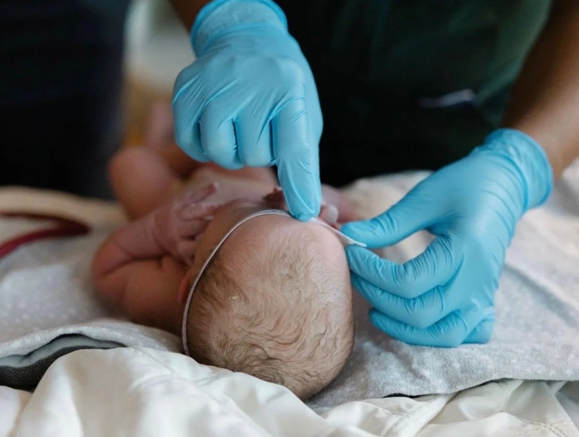 Community midwife using a measuring tape to check the head circumference during the immediate postpartum after delivery.