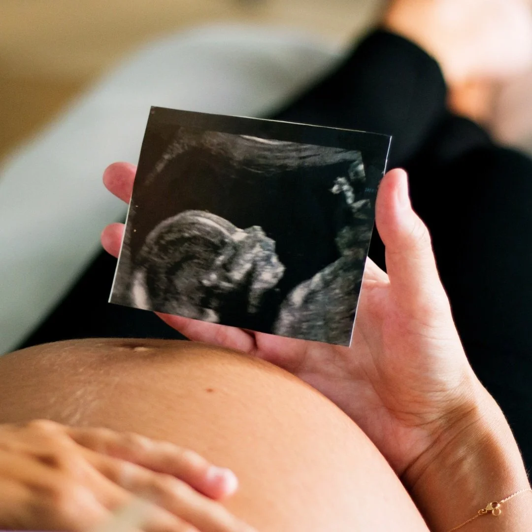 How and Why Down Syndrome Can Go Undetected in Pregnancy