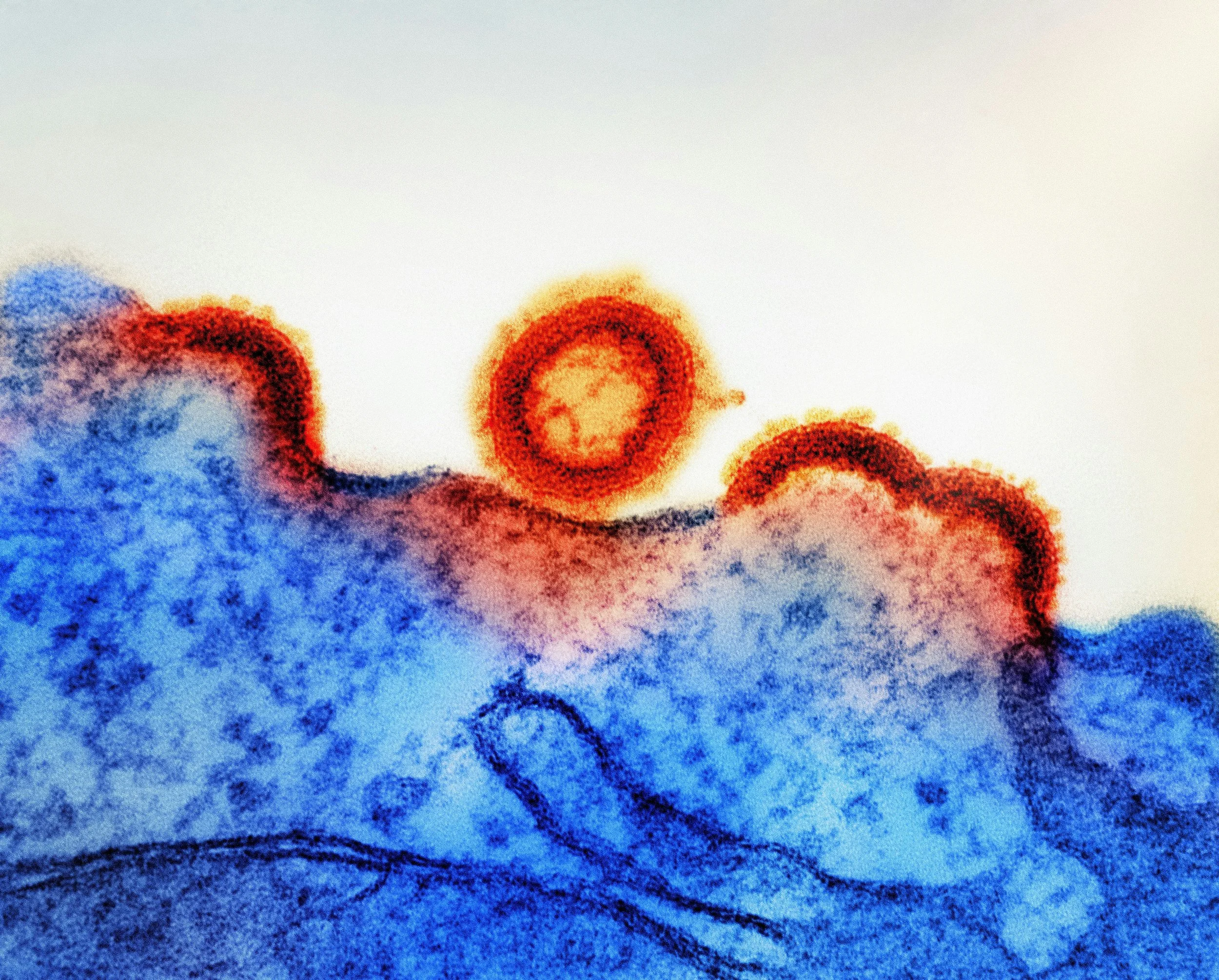 Centers for Disease Control and Prevention