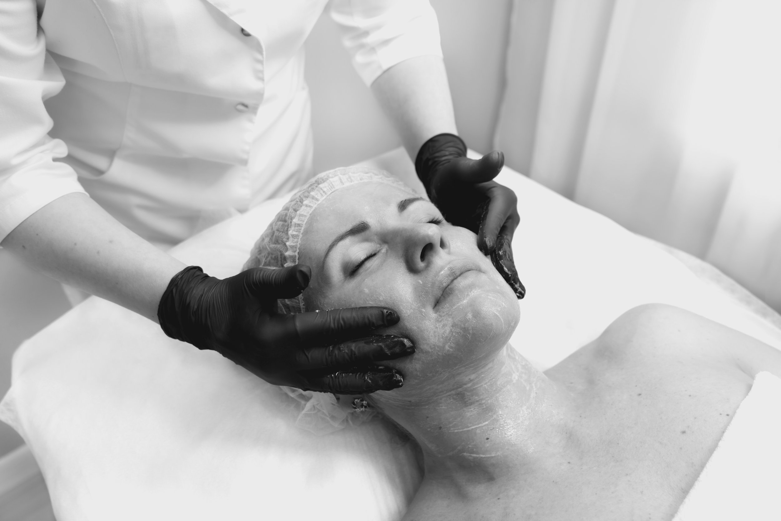 Chemical Peel