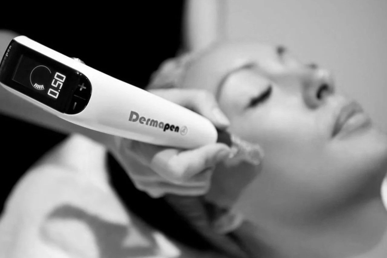 Microneedling