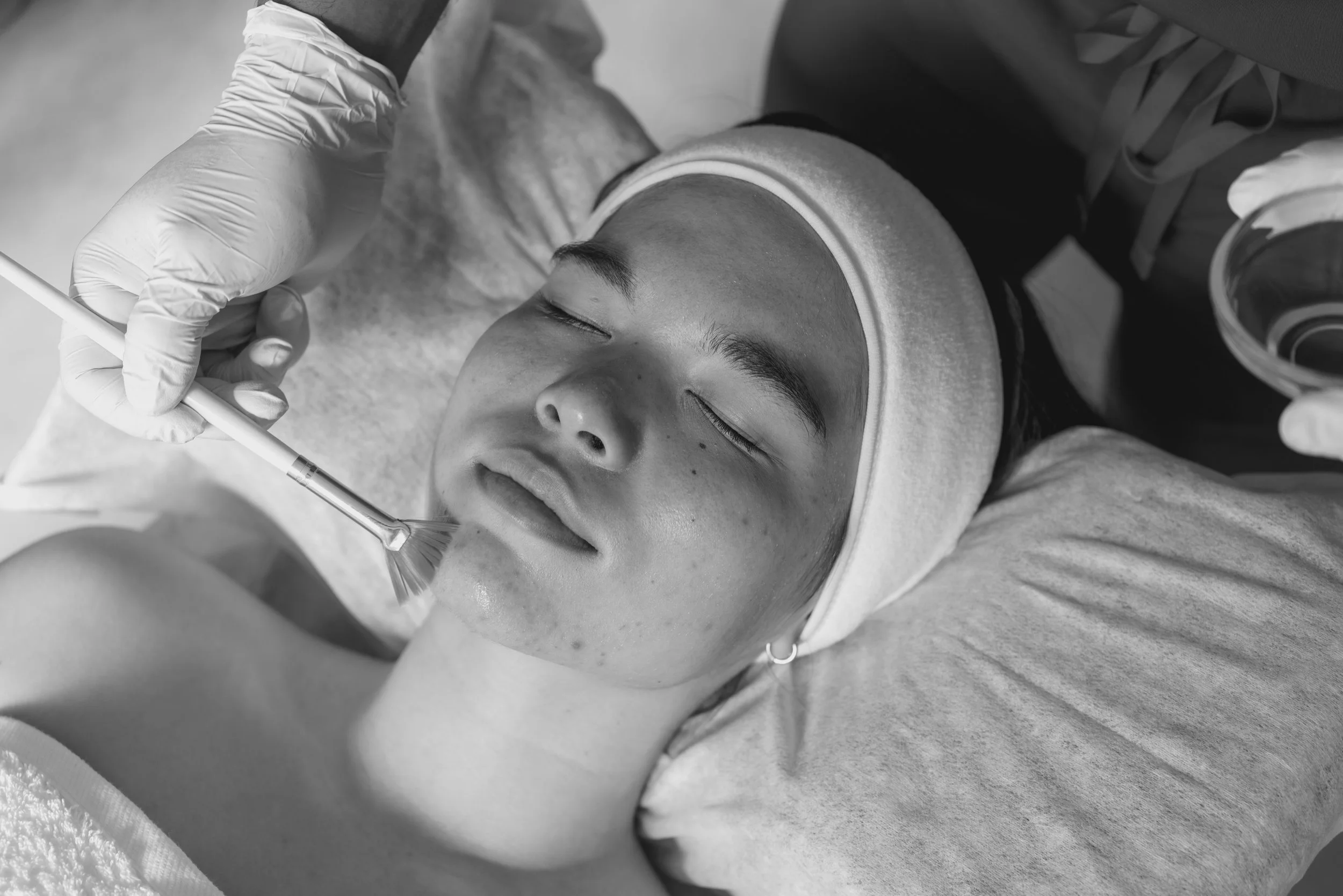 Glow and Renew Peel Package