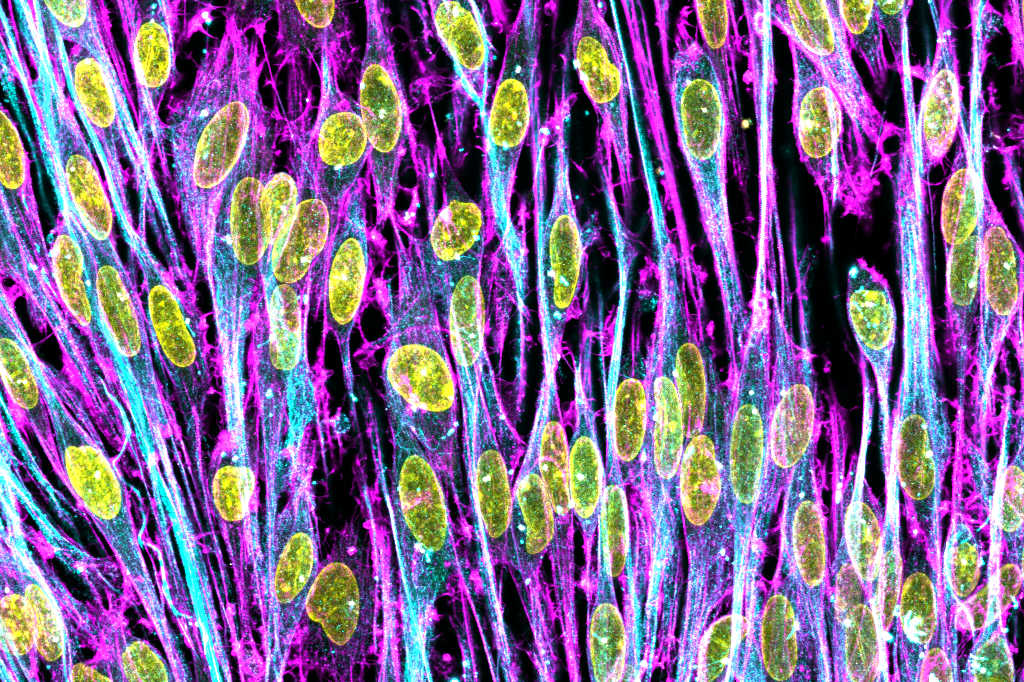Murine Schwann cells on the surfaces of hydrogels
