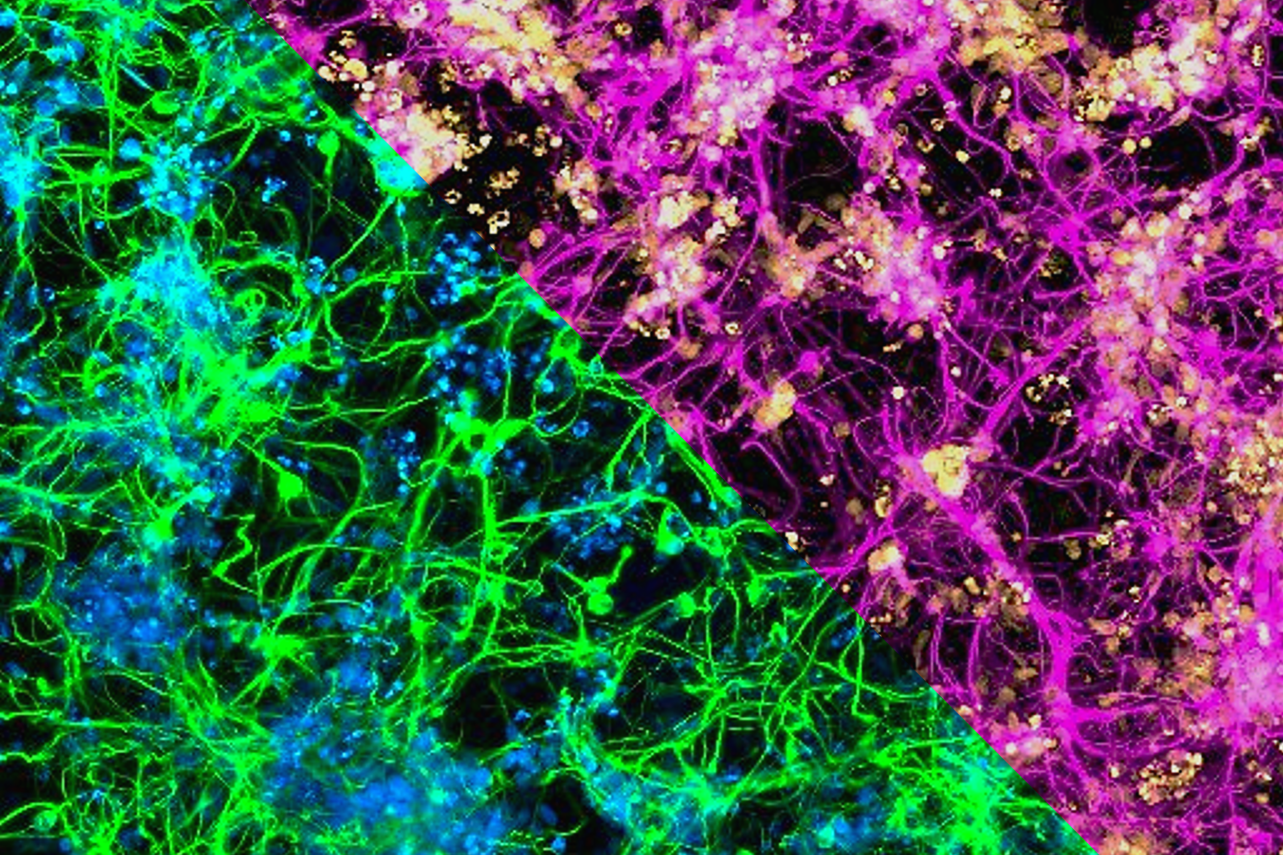 Human neural progenitor cells encapsulated in 3D hydrogels