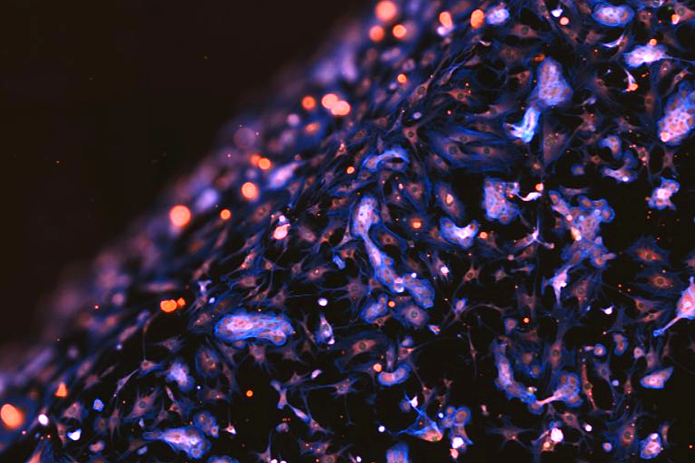 Human keratinocytes on 2D culture systems 