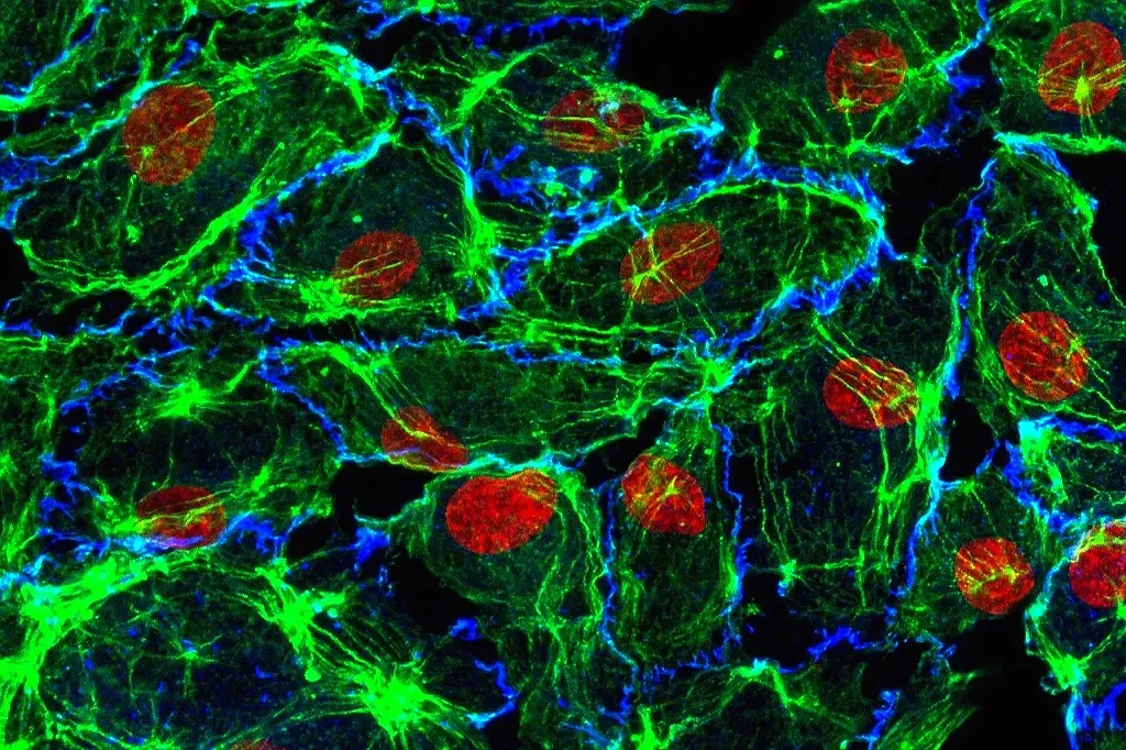 Human endothelial cells on 3D printed biomaterials
