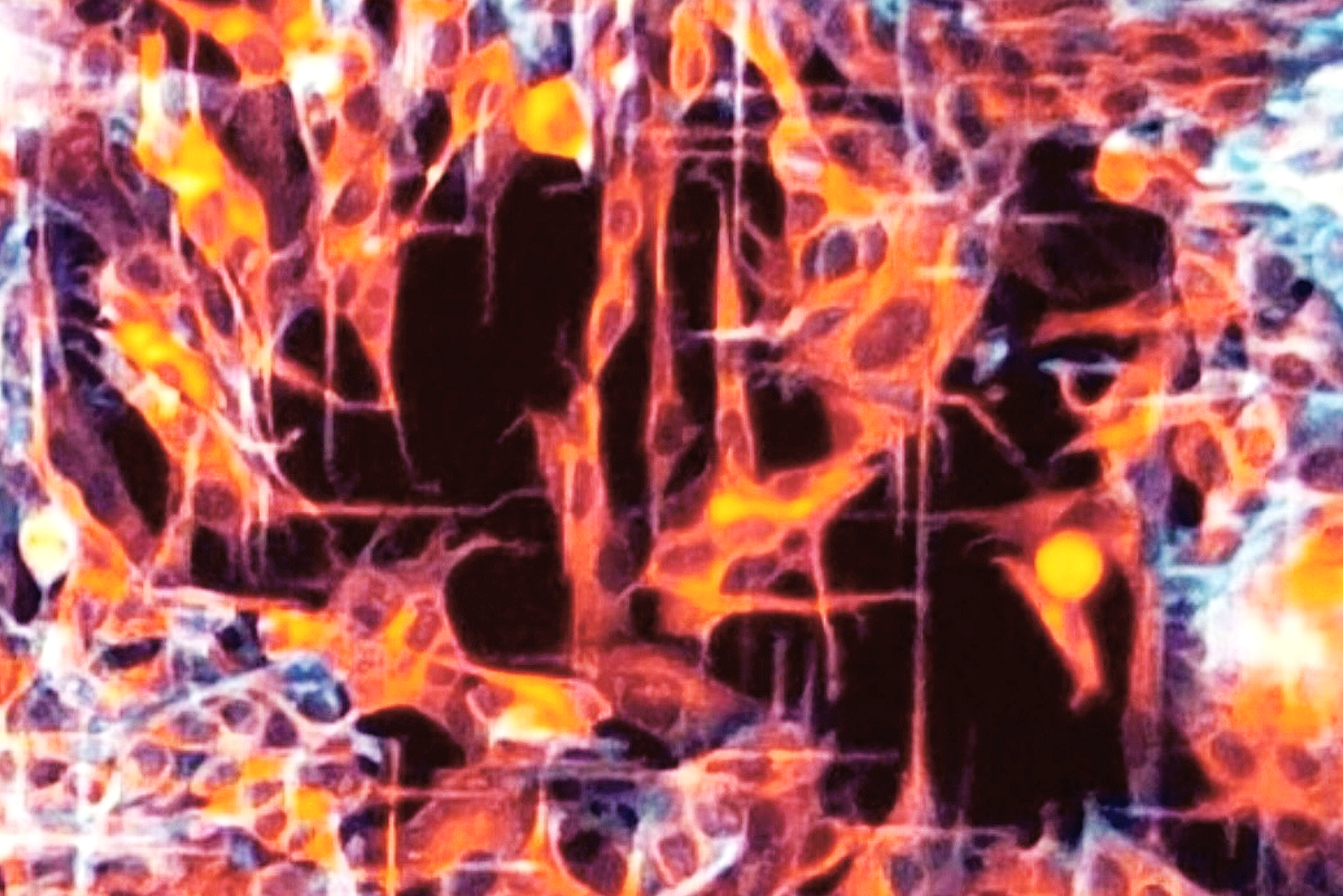 Human-derived neuroblastoma cells on micropatterned structures 