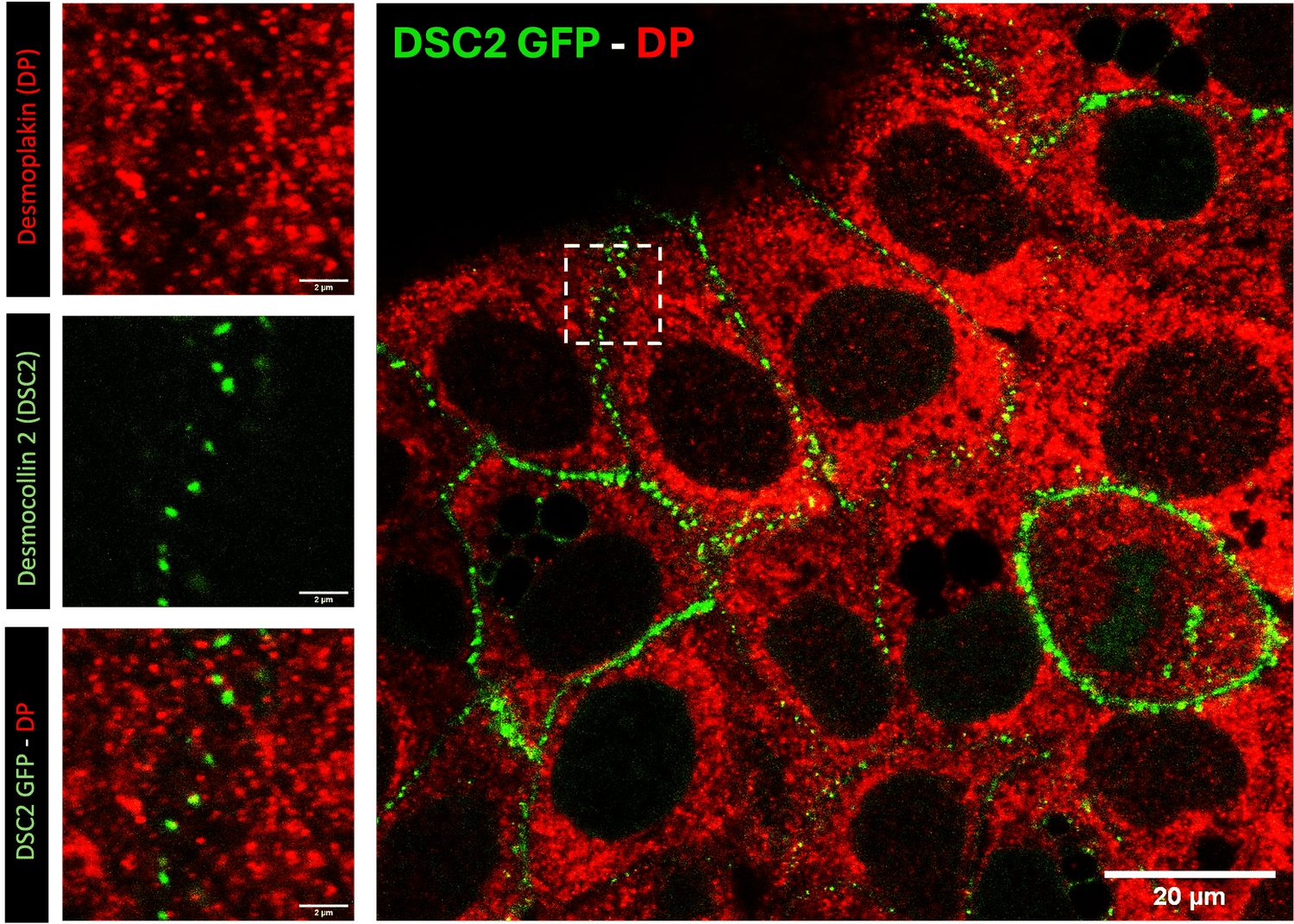 High-resolution fluorescence imaging of desmosome organization in HaCaT keratinocytes