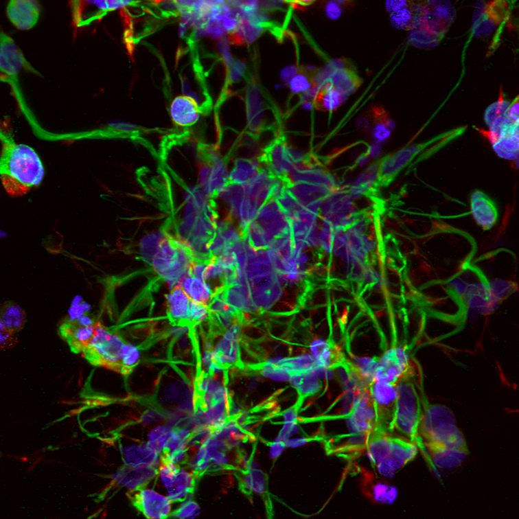 Colorful microscopic view of neurons with neurite- ICC- βIII-Tubulin: marking neurite extensions
 🔴 F-actin: cytoskeletal structure
 🔵 DAPI: nuclear staining, #NeuralProgenitorCells hashtag#Neurodevelopment hashtag#NeuralDifferentiation hashtag#Neu