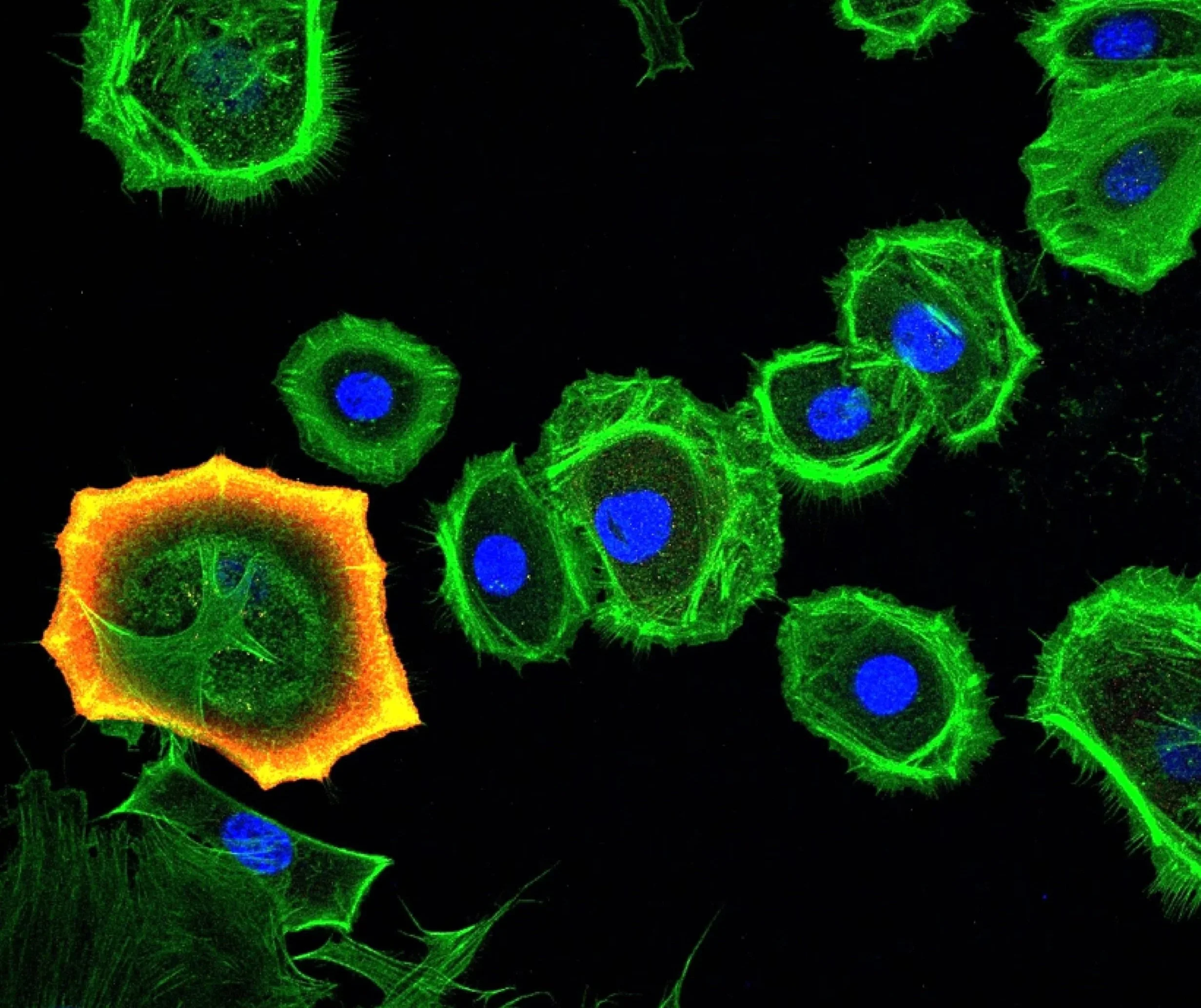 Immunofluorescence image
