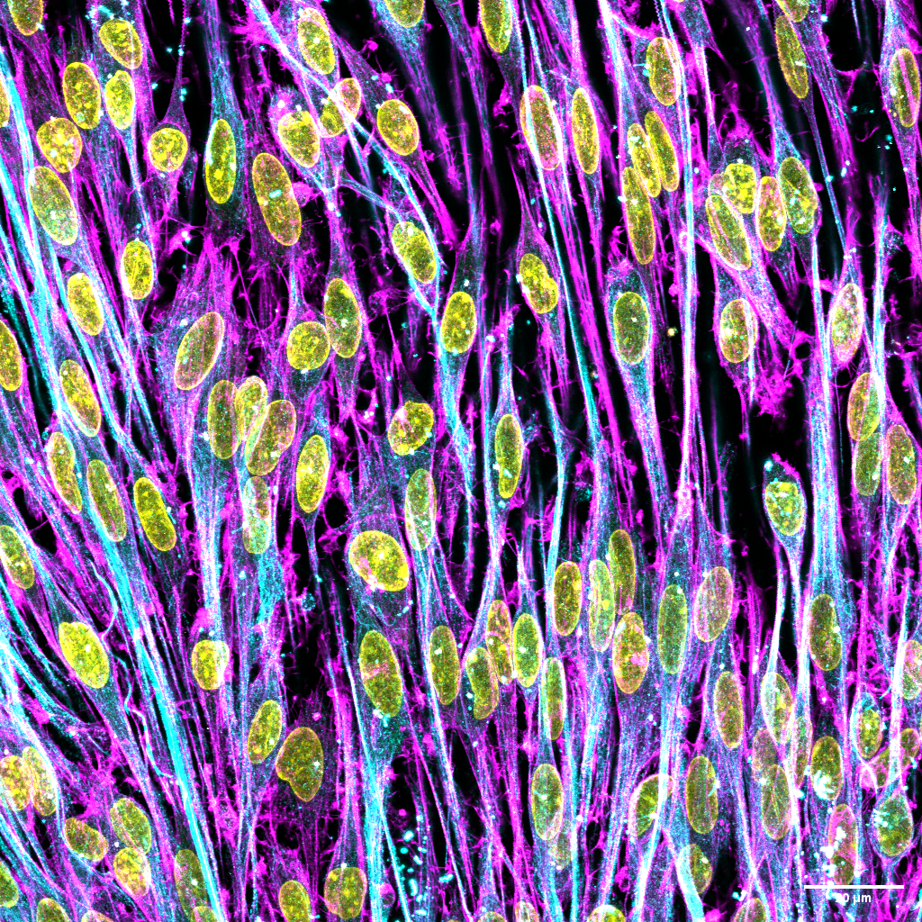 Fluorescence image of Schwann cells