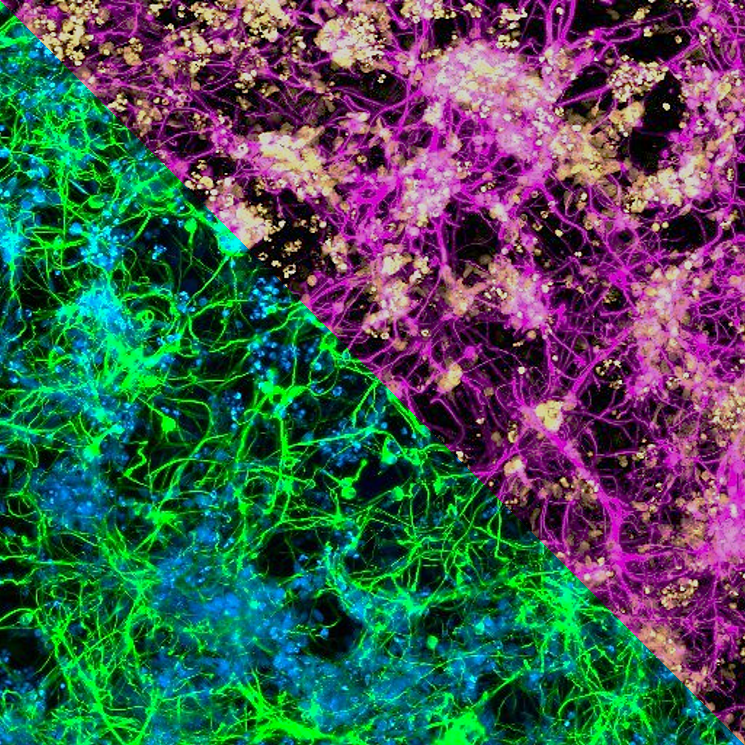 Fluorescein staining of neural cells showing intricate network-like patterns.