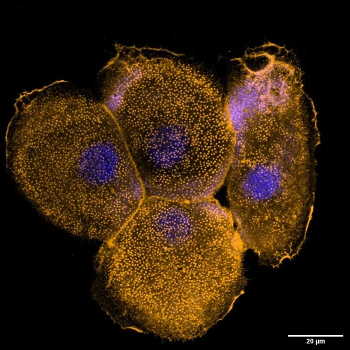 Human keratinocyte on protein-patterned surfaces thumbnail