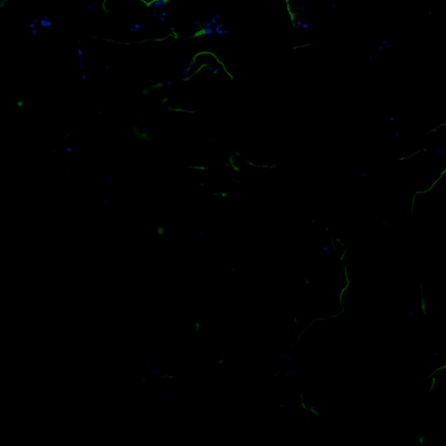 Fluorescence imaging GIF
