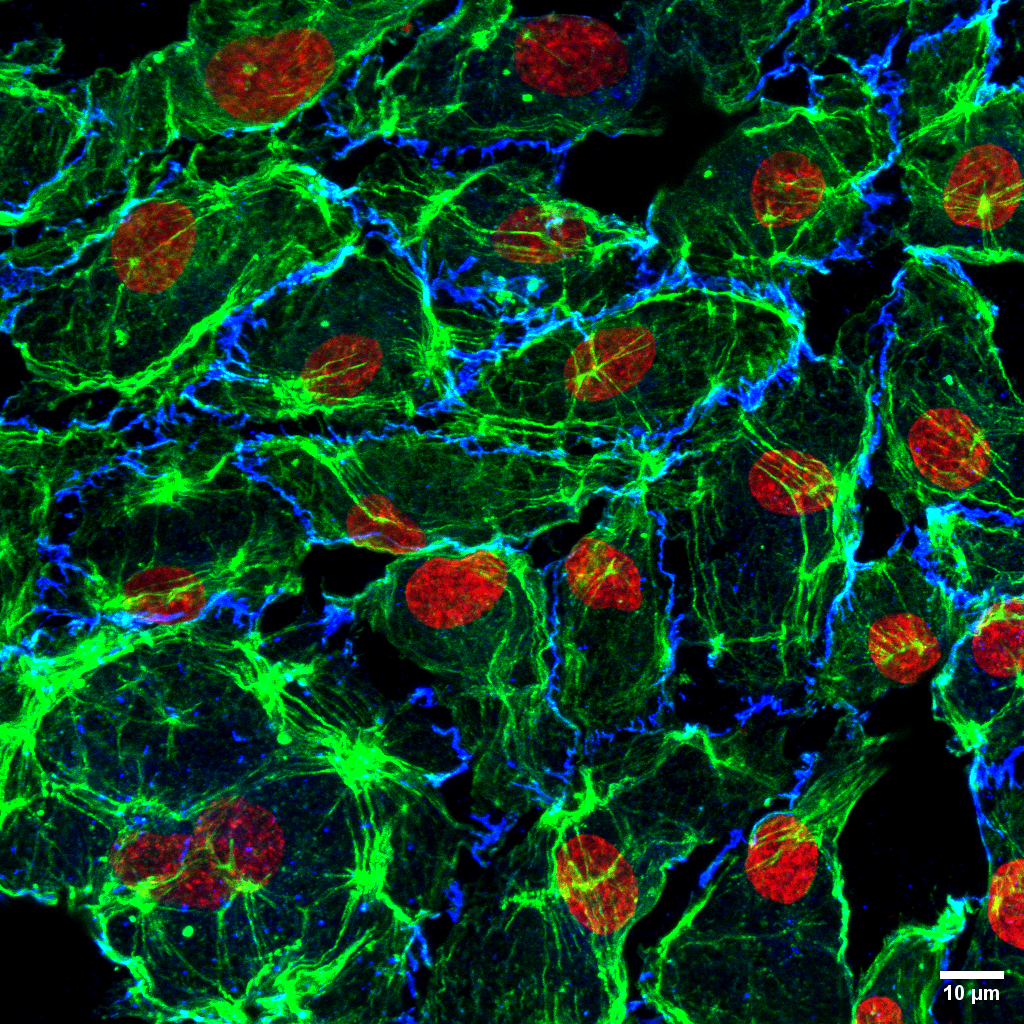 Nuclei (DAPI) human#endothelial cells cultured within a#bioprinted artificial#vascular system
 🟢 F-actin (Phalloidin, cytoskeleton)
 🔵 VE‑cadherin (endothelial junctions)#EndothelialCells#Bioprinting