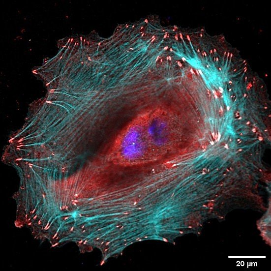 This week, we’re showcasing human hashtag#keratinocytes cultured on an#engineered cell-instructive surface designed to probe cell-matrix interactions.
Using#fluorescent labeling, we visualized:
🔴 Vinculin: a key component of focal a