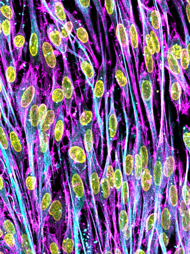 A microscopic view of a network of colorful cells, with pink and purple filaments and yellow oval-shaped structures.